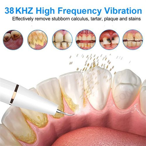 Smart Ultra-Sonic Teeth Cleaner